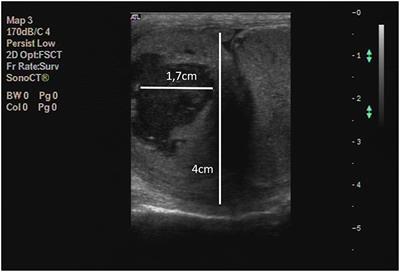 A Rare Case of a Primary Unilateral Low-Grade Paratesticular Leiomyosarcoma in a 2 Years Old Dog